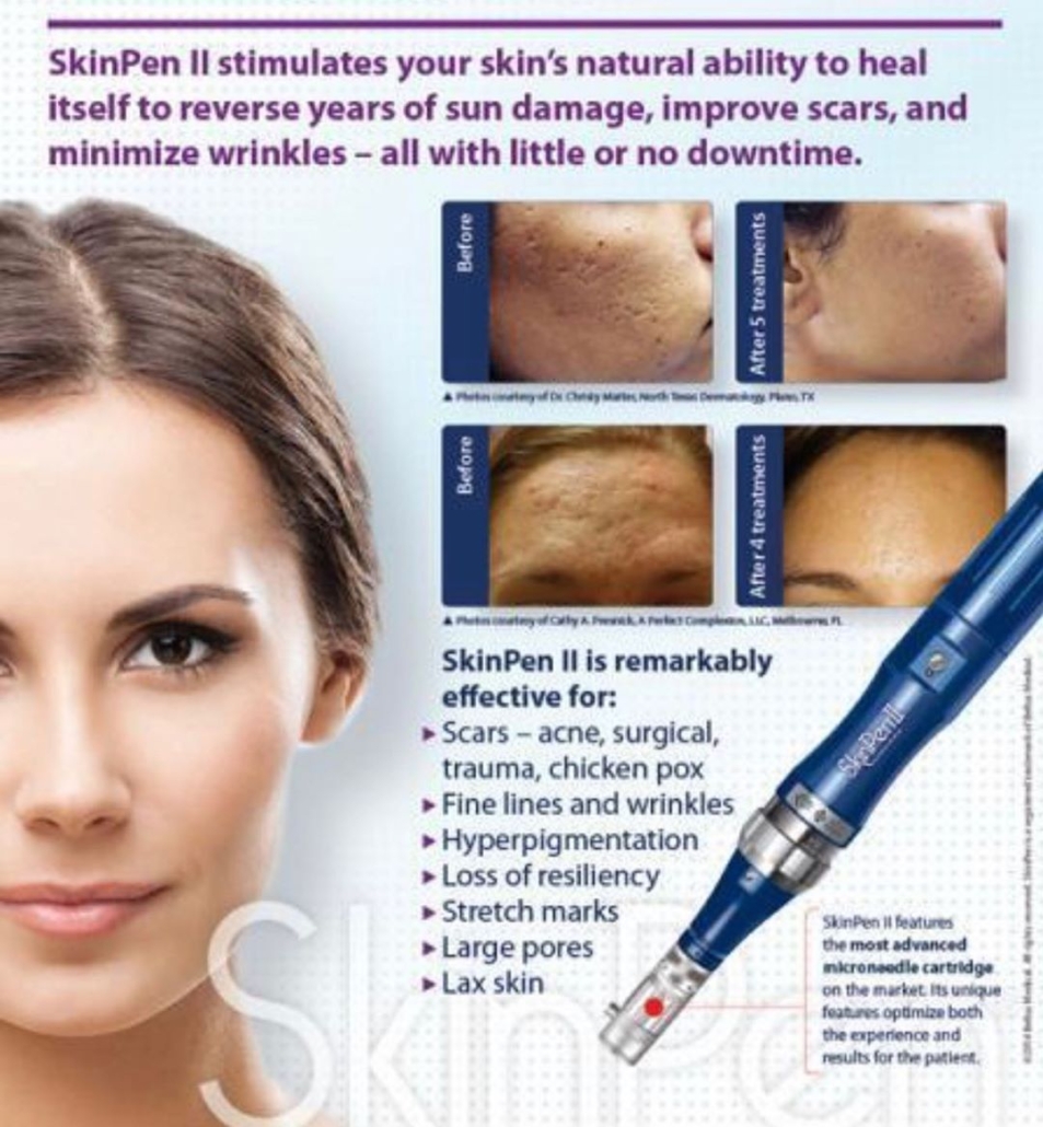 SkinPen Micro-Needling - Pittsfield, MA