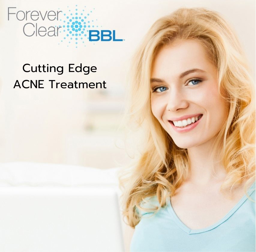 Forever Clear BBL for Acne - Pittsfield, MA